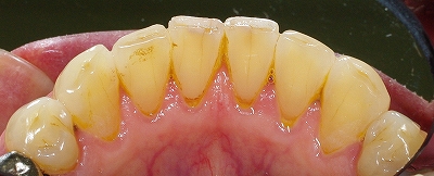 溝の口の歯医者