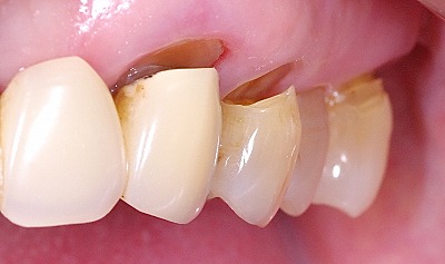 定期健診 予防歯科 あき歯科医院の医院ブログ