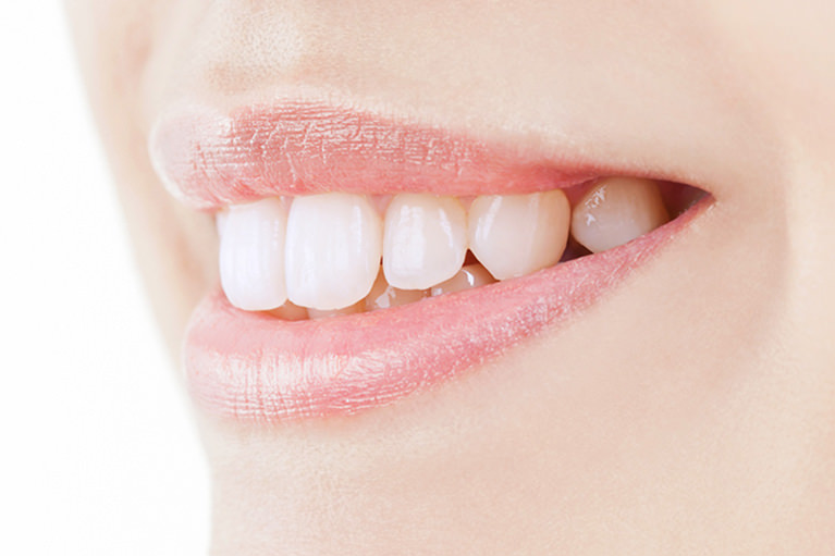 当院の審美歯科の治療の特徴