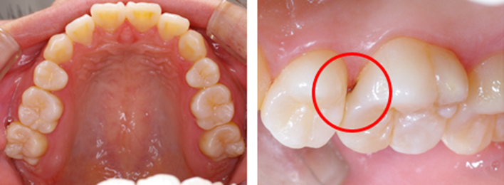虫歯や歯周病のリスクからお口の健康を守る02